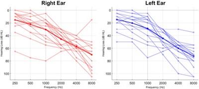 Reasons for ceiling ratings in real-life evaluations of hearing aids: the relationship between SNR and hearing aid ratings
